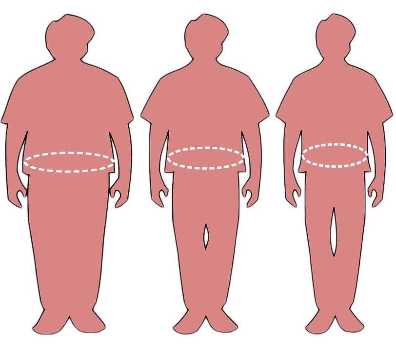 Gelut anu épéktip ngalawan obesitas berkat KETO Complete